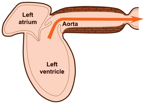 Pulse wave generation as aorta elasticity decreases.